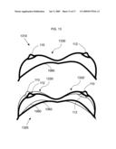 Computer analysis of a breast shape to assist breast surgery diagram and image