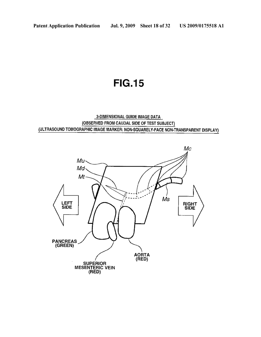 MEDICAL SYSTEM AND METHOD FOR GENERATING MEDICAL GUIDE IMAGE - diagram, schematic, and image 19