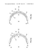 Fluid injection deflector shield viewing apparatus and method diagram and image