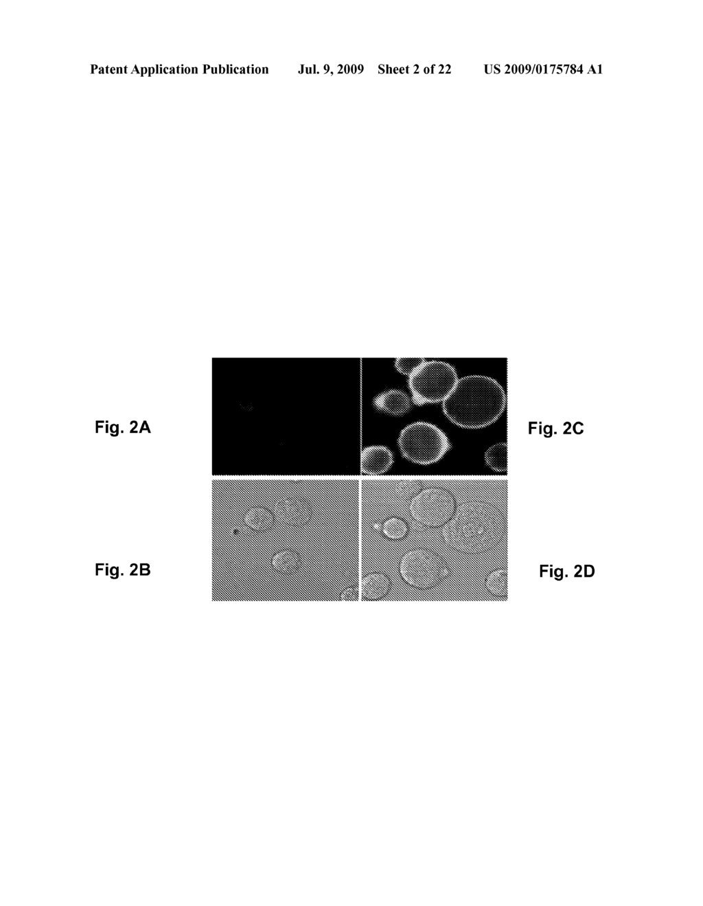 Anti-Alpha V Immunoliposome Composition, Methods, and Uses - diagram, schematic, and image 03