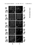 CNS-TUMOR TREATMENT METHOD AND COMPOSITION diagram and image