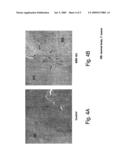 CNS-TUMOR TREATMENT METHOD AND COMPOSITION diagram and image