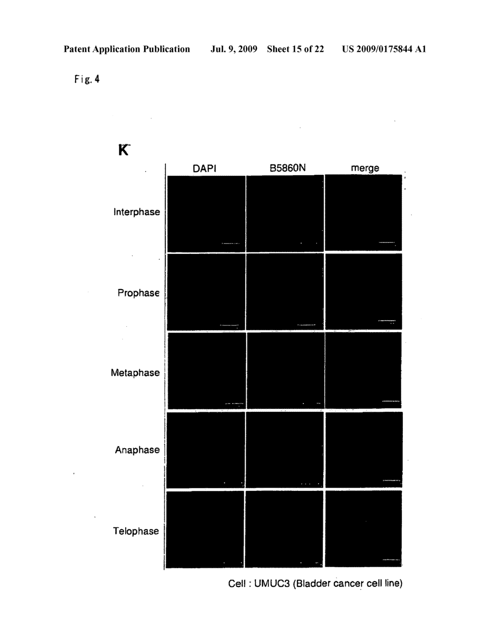 METHOD OF DIAGNOSING BLADDER CANCER - diagram, schematic, and image 16