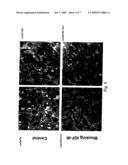 IGF-IR antagonists as adjuvants for treatment of prostate cancer diagram and image