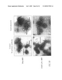 MEASLES SUBUNIT VACCINE diagram and image