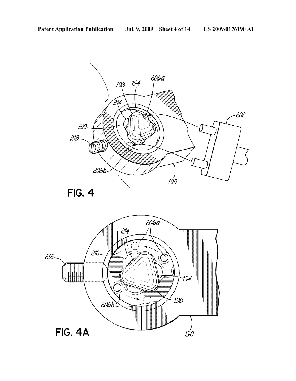 SCREW ANCHORED ORTHODONTIC APPLIANCE AND METHODS - diagram, schematic, and image 05