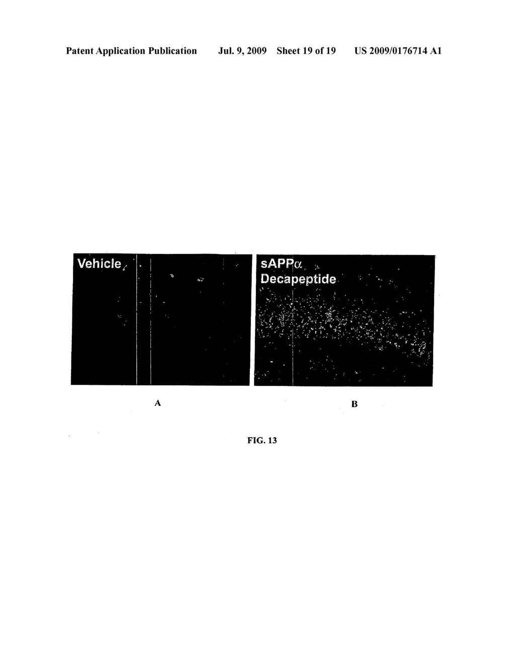 METHOD OF REDUCING THE EFFECTS OF ABeta AND COMPOSITIONS THEREFORE - diagram, schematic, and image 20