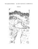 METHODS RELATING TO THE TREATMENT OF FIBROTIC DISORDERS diagram and image