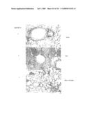 METHODS RELATING TO THE TREATMENT OF FIBROTIC DISORDERS diagram and image