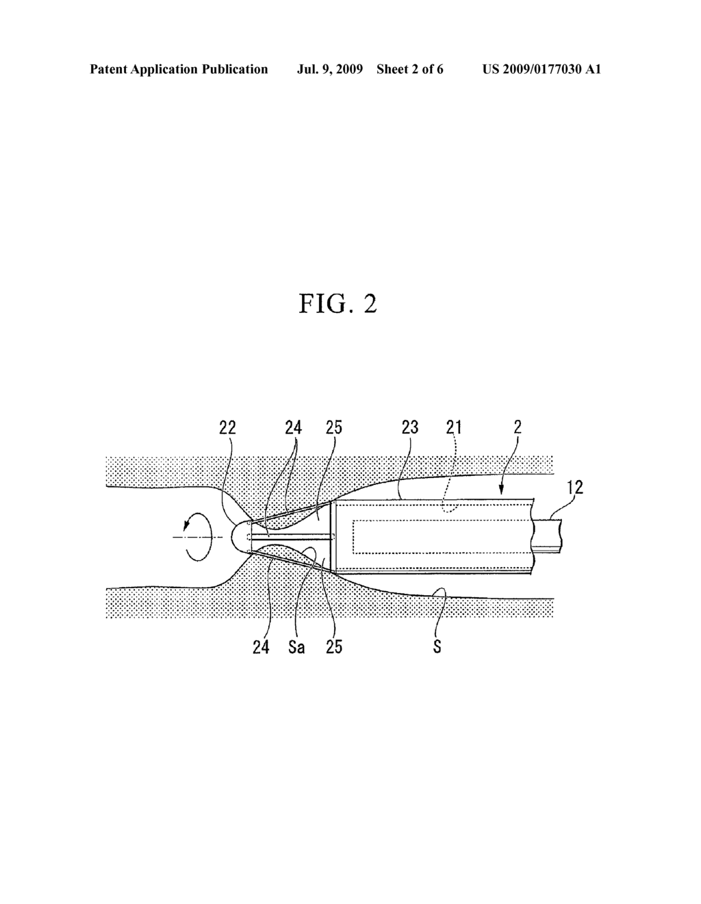 ENDOSCOPIC INCISION SYSTEM - diagram, schematic, and image 03