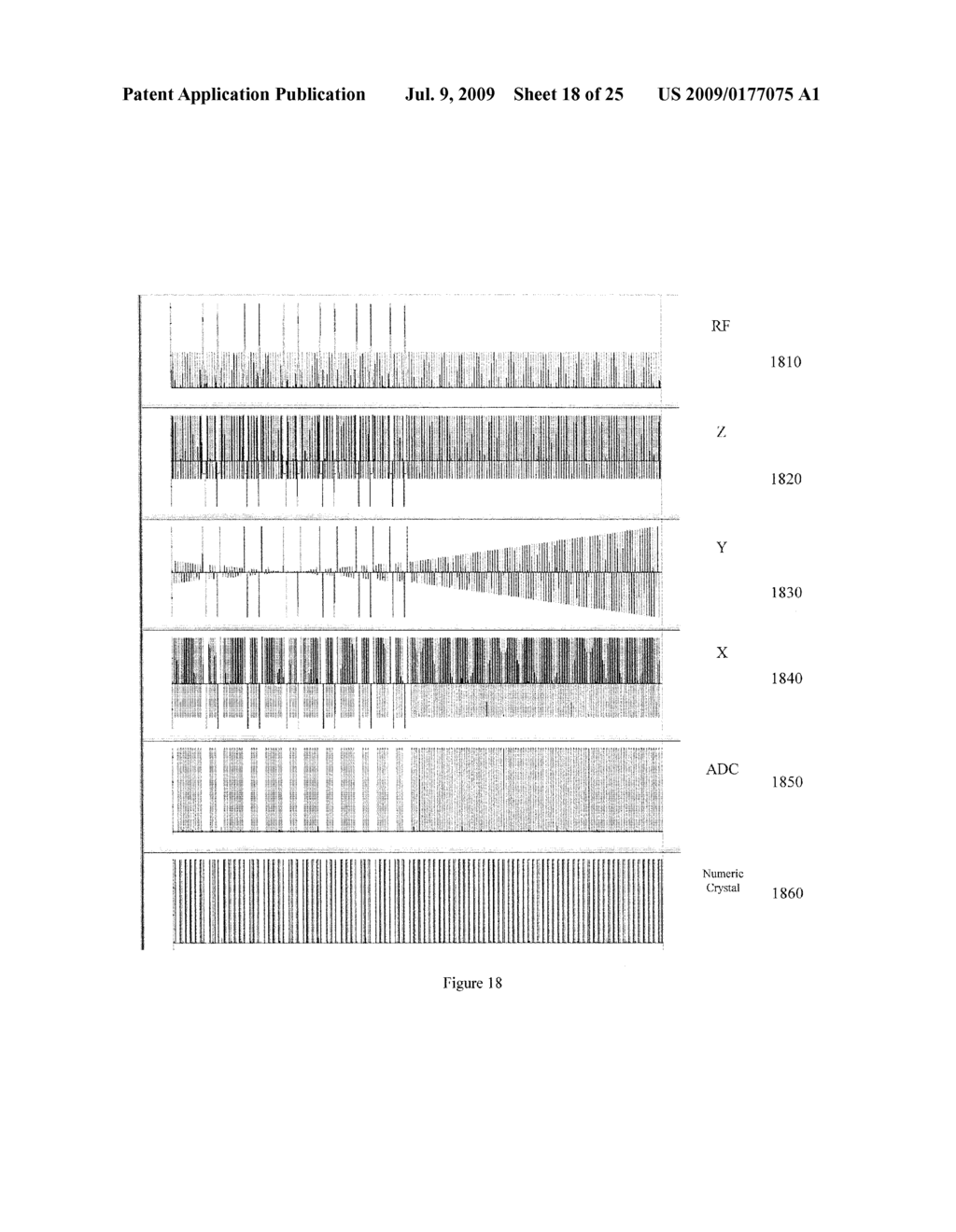 Resolution enhanced T1-insensitive steady state imaging (RE-TOSSI) - diagram, schematic, and image 19