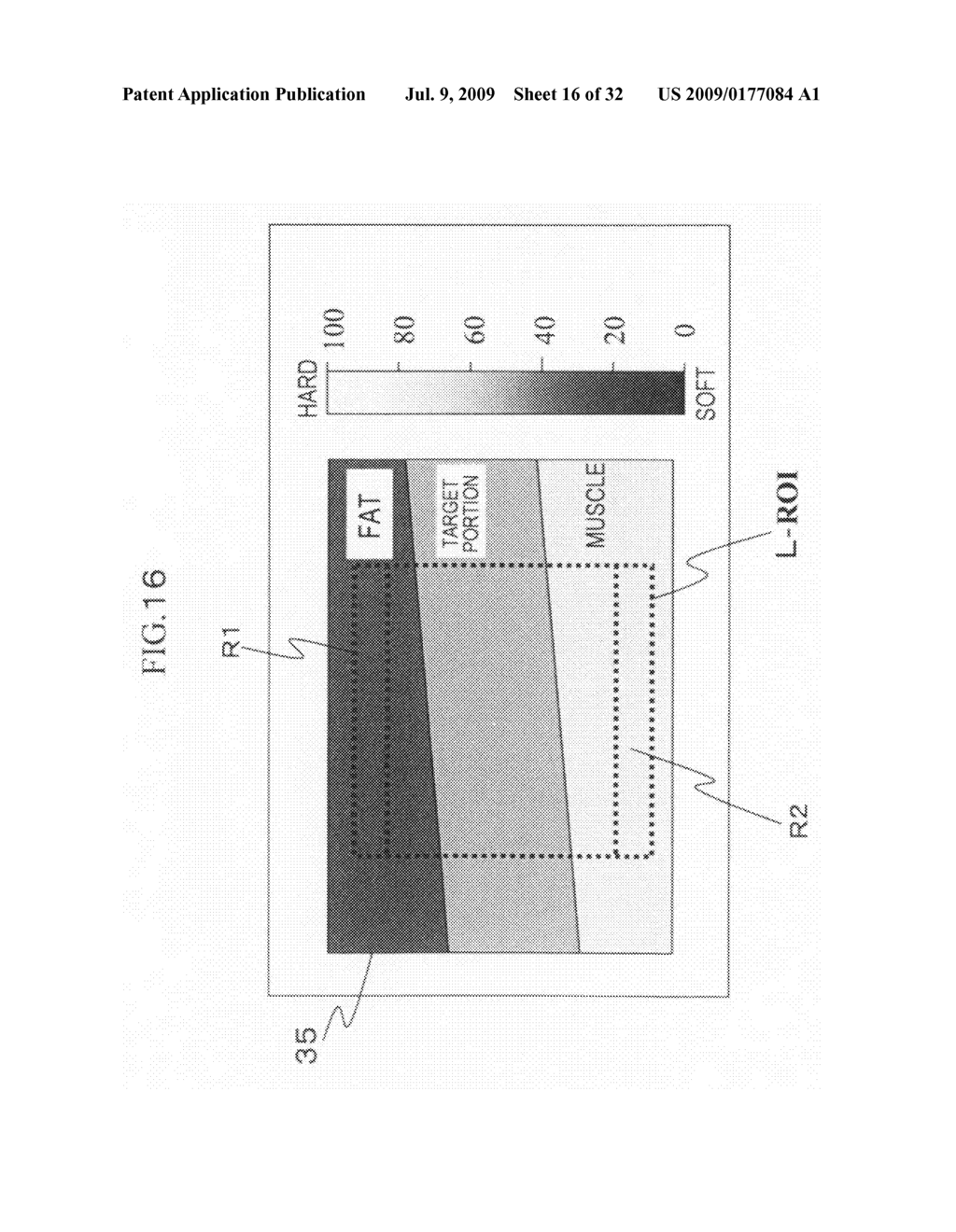 Ultrasonic Diagnostic Apparatus - diagram, schematic, and image 17