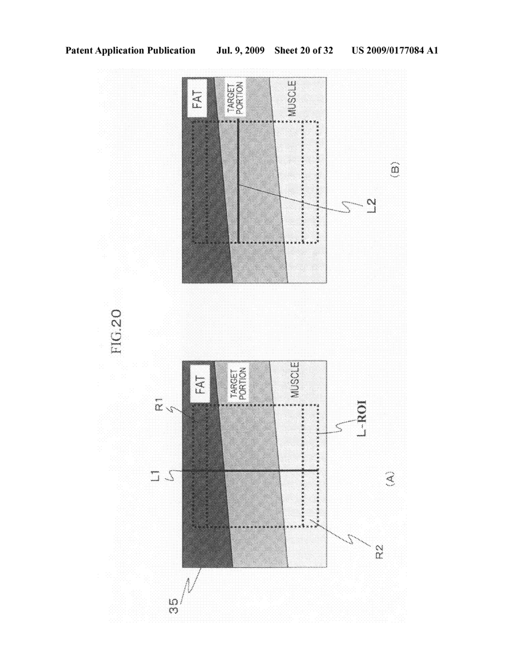 Ultrasonic Diagnostic Apparatus - diagram, schematic, and image 21