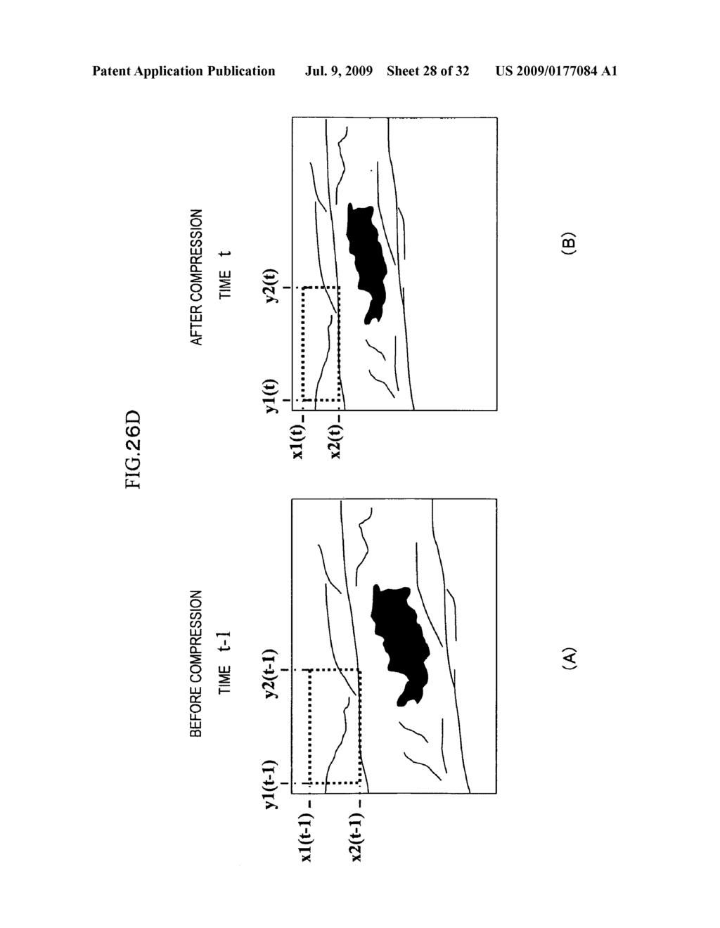 Ultrasonic Diagnostic Apparatus - diagram, schematic, and image 29