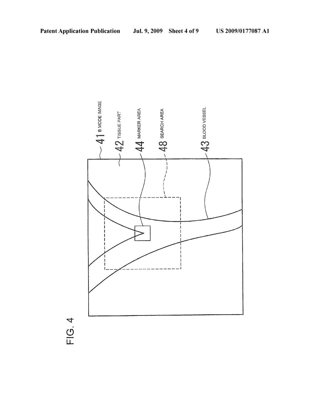 ULTRASONIC IMAGING APPARATUS - diagram, schematic, and image 05