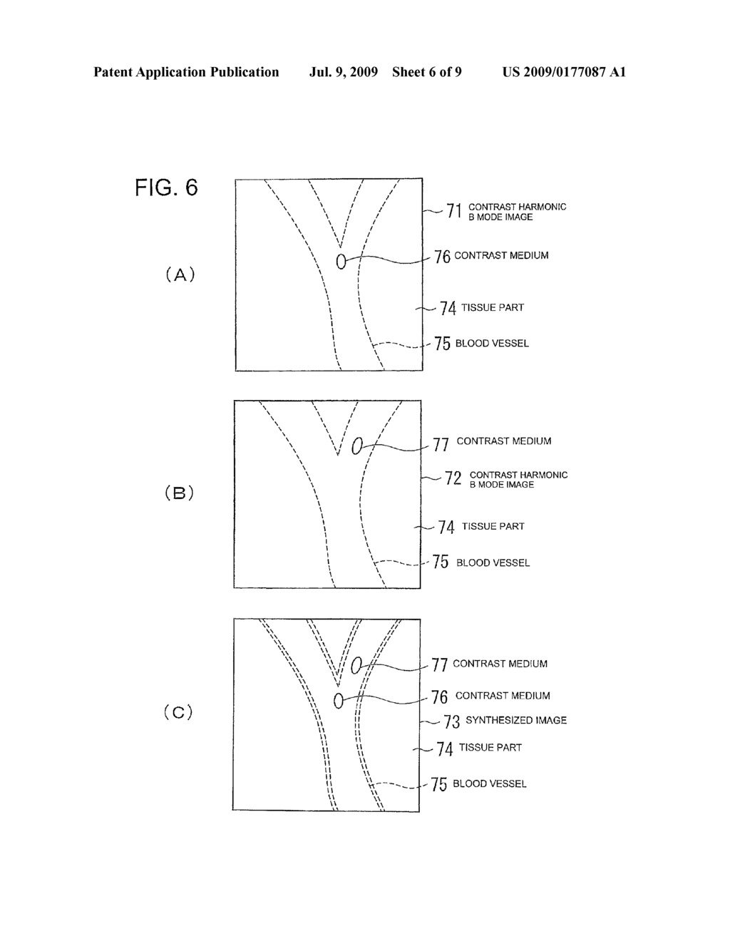 ULTRASONIC IMAGING APPARATUS - diagram, schematic, and image 07