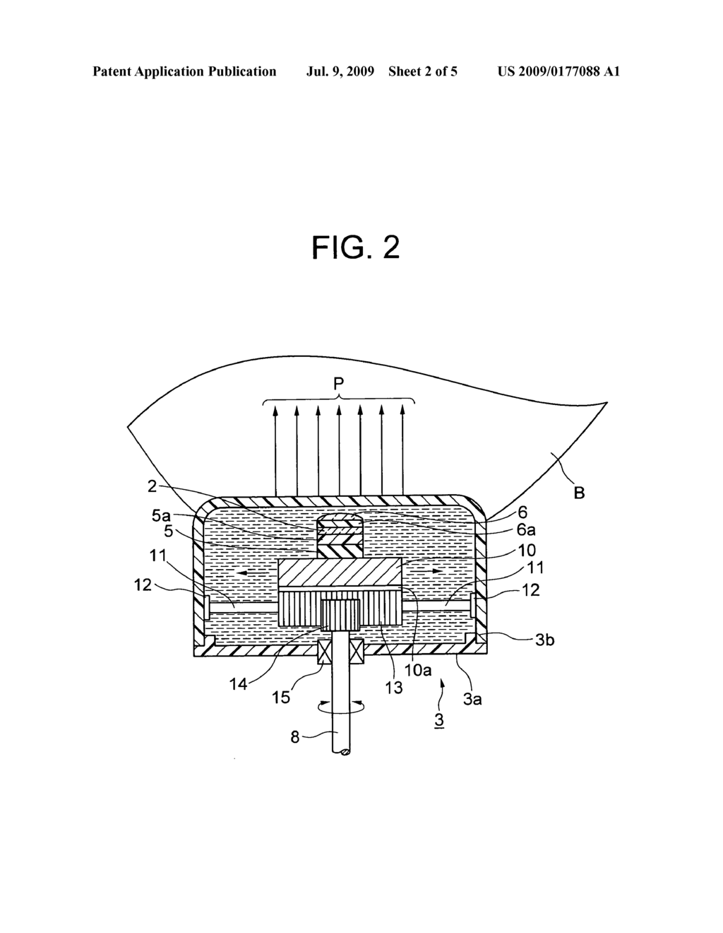 Ultrasonic Probe - diagram, schematic, and image 03