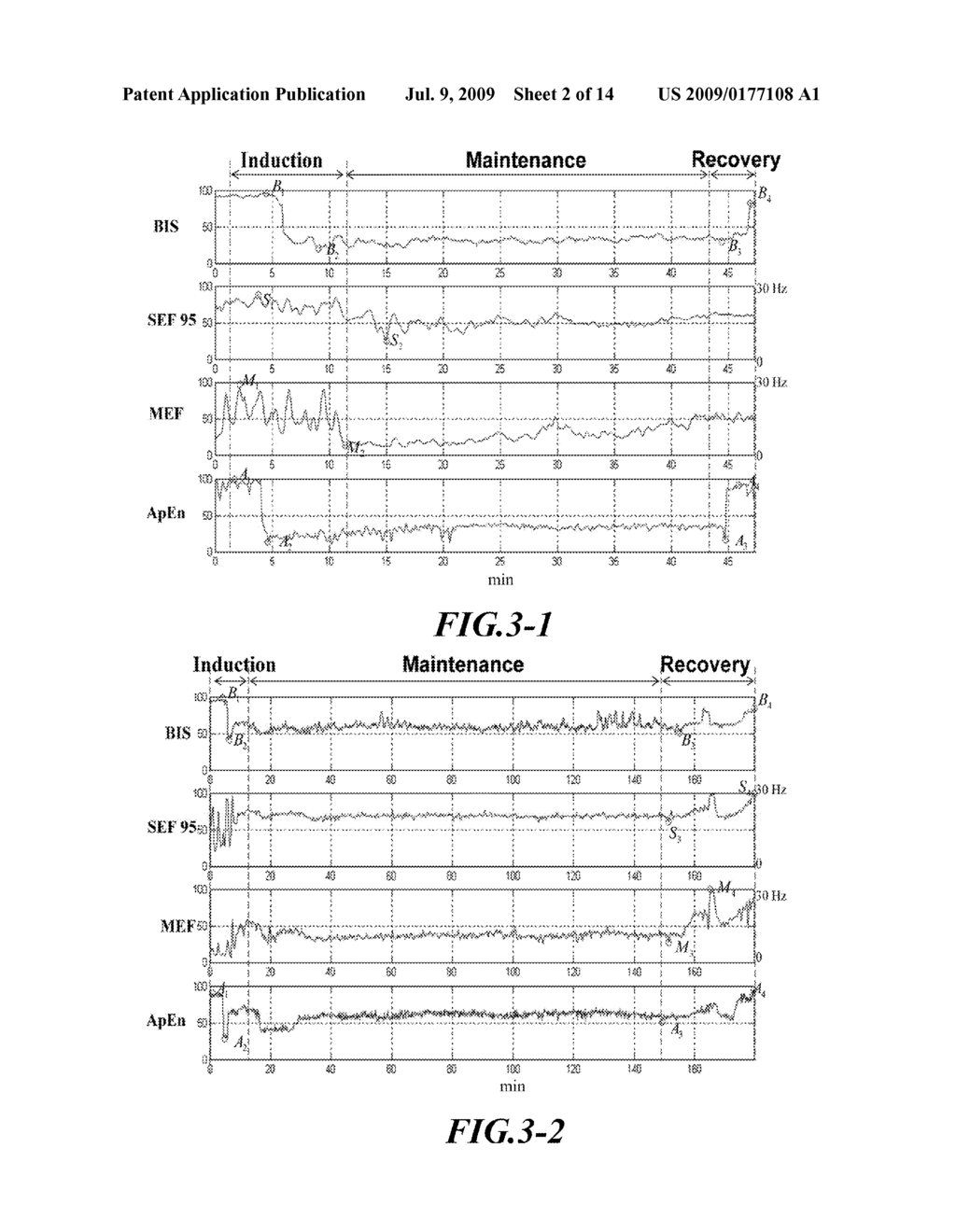 Method for Monitoring the Depth of Anesthesia - diagram, schematic, and image 03