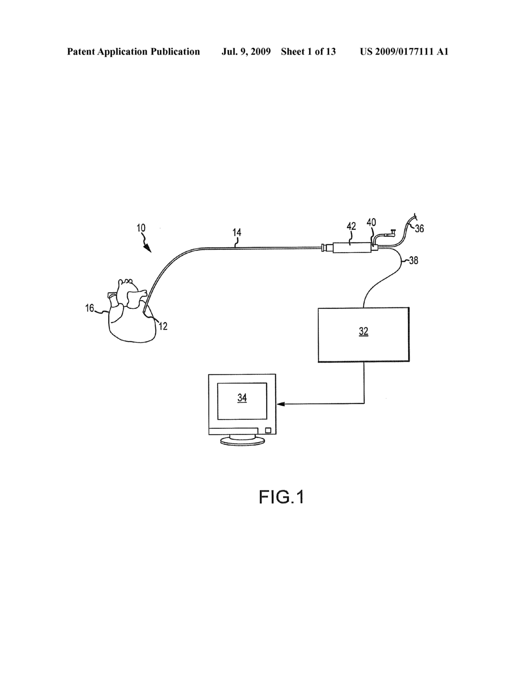 System and method for displaying contact between a catheter and tissue - diagram, schematic, and image 02