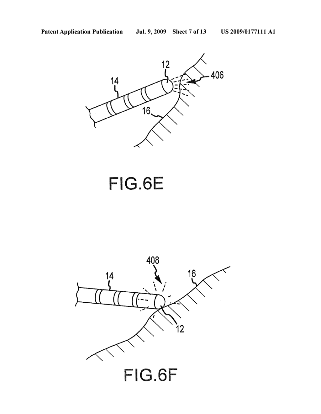 System and method for displaying contact between a catheter and tissue - diagram, schematic, and image 08