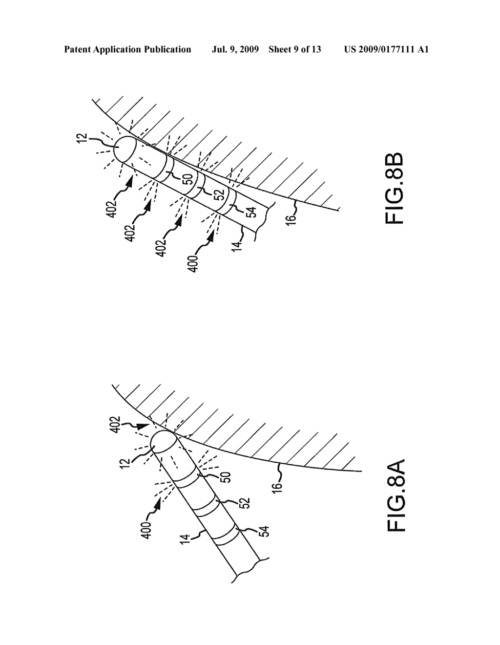 System and method for displaying contact between a catheter and tissue - diagram, schematic, and image 10