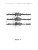 MICROMACHINED NEURAL PROBES diagram and image