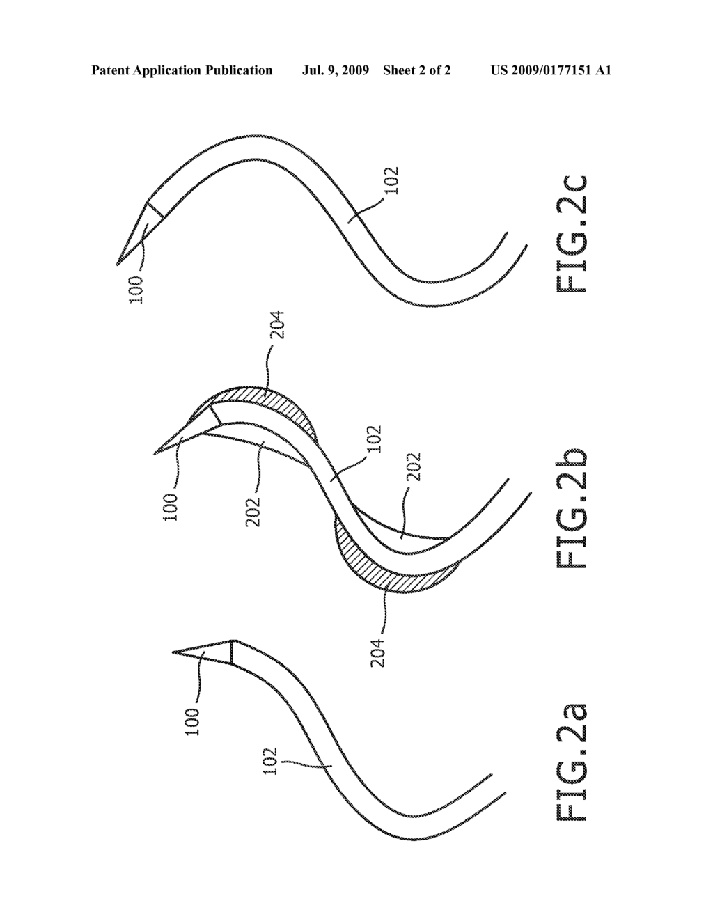 SURGICAL NEEDLE AND METHOD OF GUIDING A SURGICAL NEEDLE - diagram, schematic, and image 03