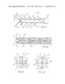 HOLLOW CURVED SUPERELASTIC MEDICAL NEEDLE AND METHOD diagram and image