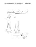 CAP DEVICE FOR USE IN THE FIXATION OF BONE STRUCTURES diagram and image