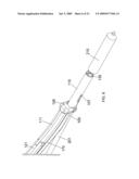 Apparatus and Methods for Separating Internal Bone Fixation Device from Introducer diagram and image