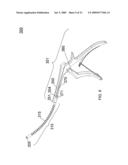 Apparatus and Methods for Separating Internal Bone Fixation Device from Introducer diagram and image