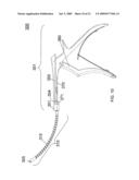 Apparatus and Methods for Separating Internal Bone Fixation Device from Introducer diagram and image