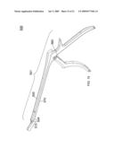 Apparatus and Methods for Separating Internal Bone Fixation Device from Introducer diagram and image