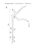 Apparatus and Methods for Separating Internal Bone Fixation Device from Introducer diagram and image