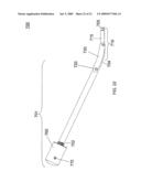 Apparatus and Methods for Separating Internal Bone Fixation Device from Introducer diagram and image