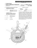 INSTRUMENTS, IMPLANTS, AND METHODS FOR FIXATION OF VERTEBRAL COMPRESSION FRACTURES diagram and image