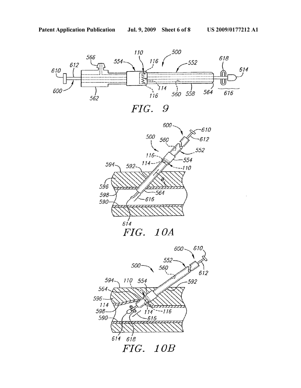 CLOSURE DEVICE AND METHODS FOR MAKING AND USING THEM - diagram, schematic, and image 07