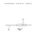 Endovascular implant for occlusion of a blood vessel diagram and image