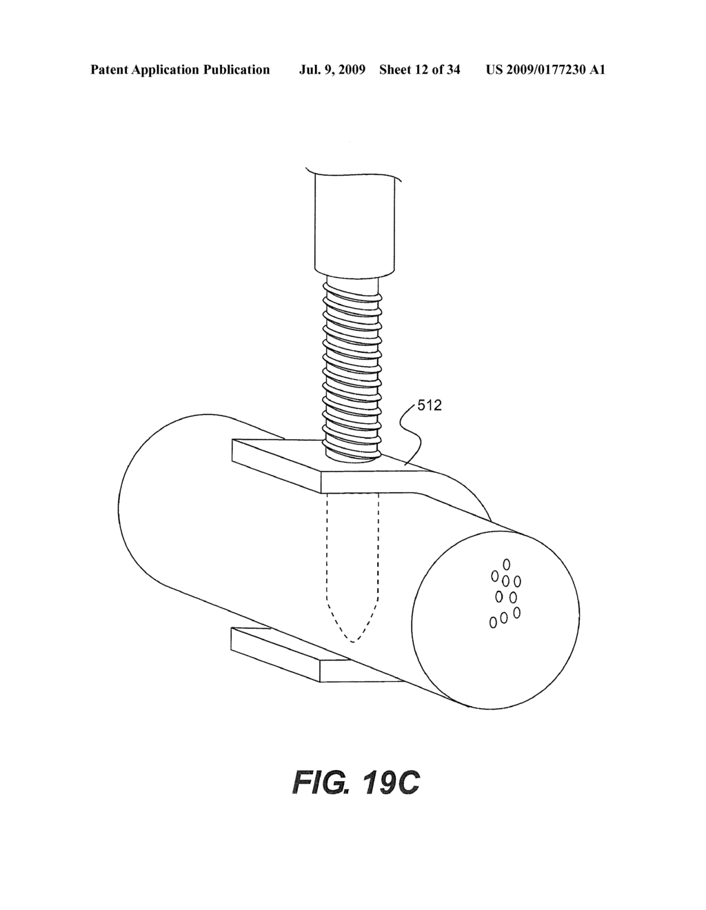 OSTEOINTEGRATION APPARATUS - diagram, schematic, and image 13