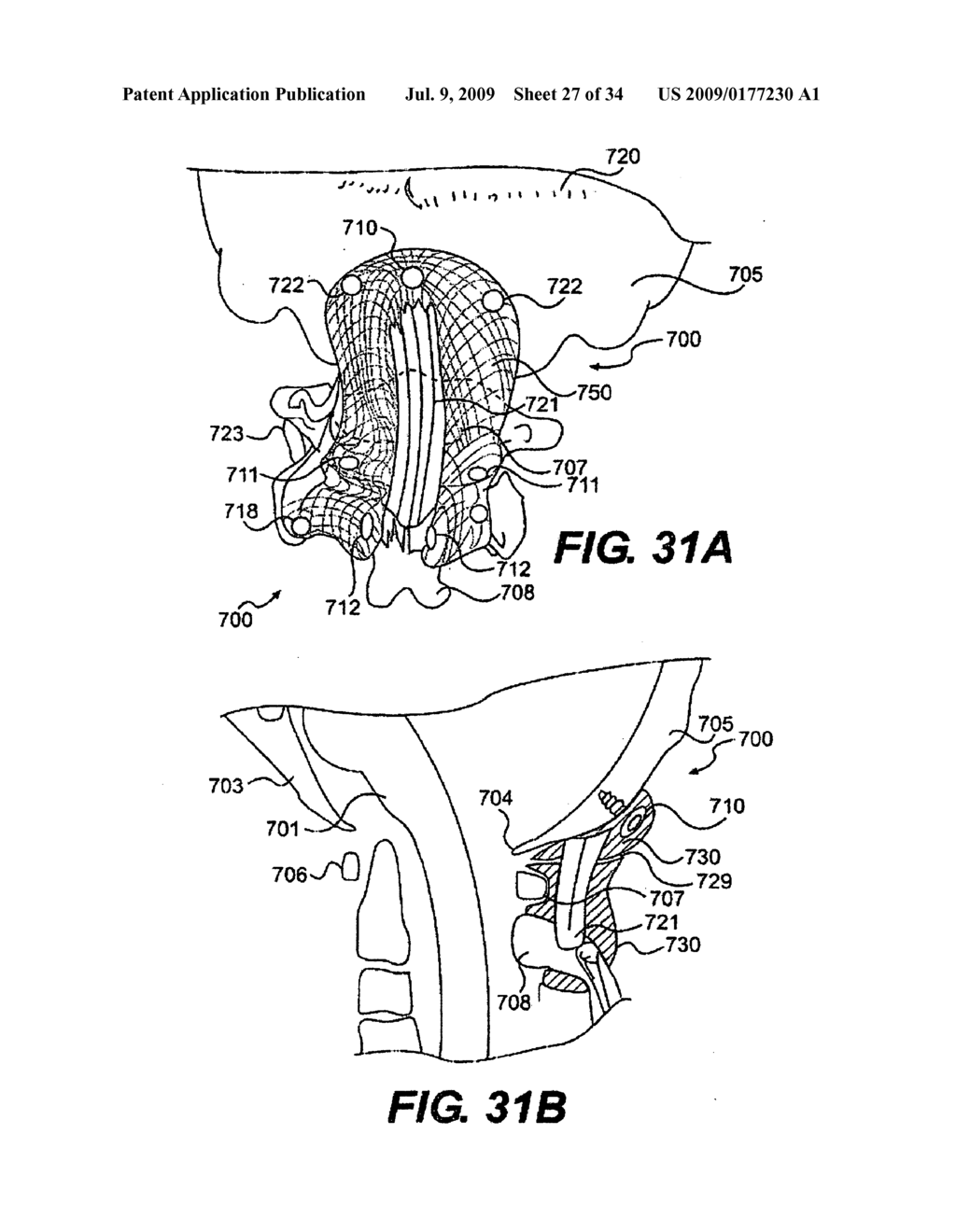 OSTEOINTEGRATION APPARATUS - diagram, schematic, and image 28