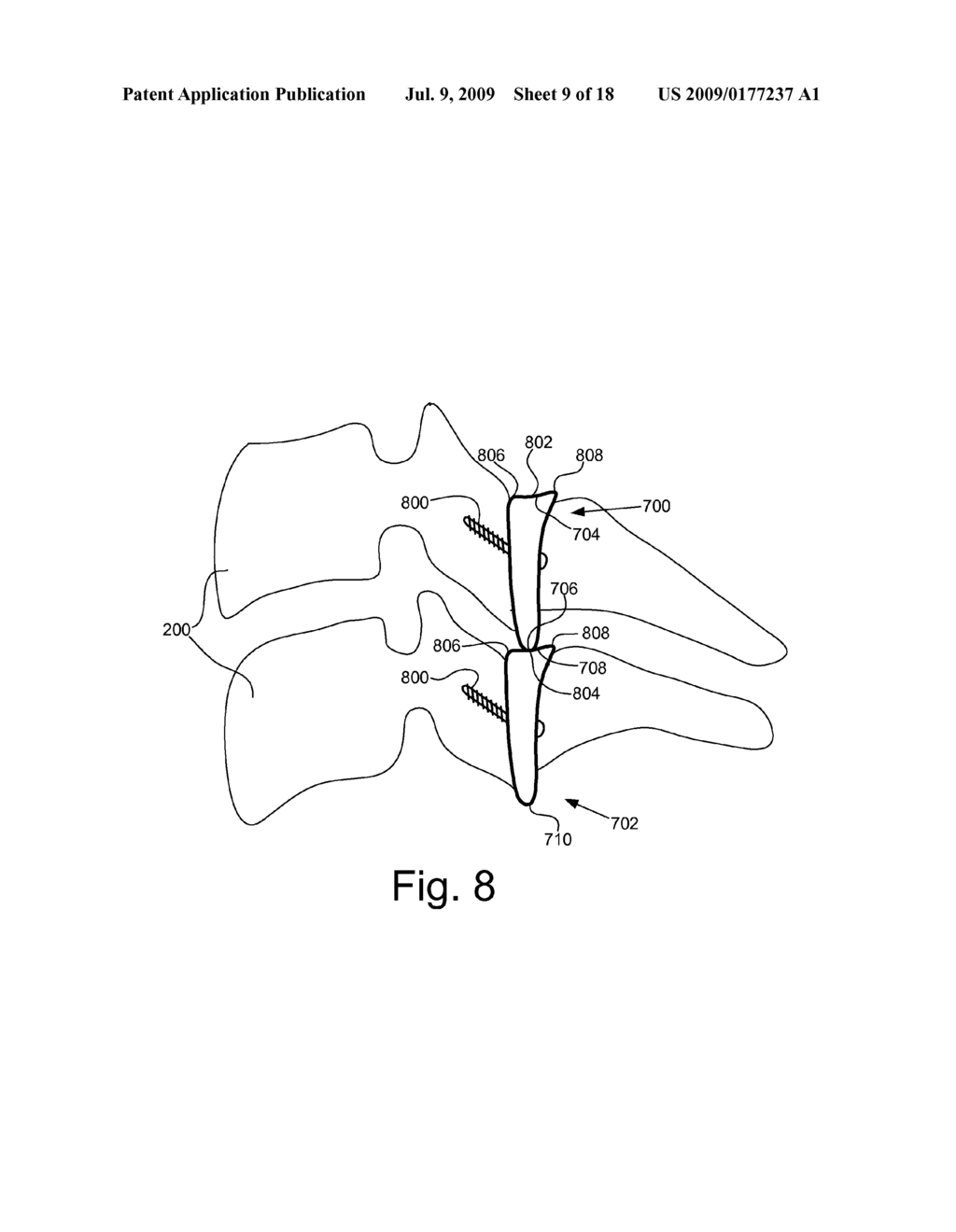 CERVICAL SPINE IMPLANT SYSTEM AND METHOD - diagram, schematic, and image 10