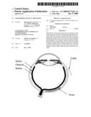 SUBCHOROIDAL RETINAL PROSTHESIS diagram and image