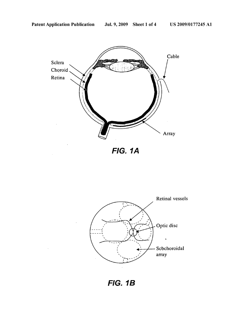 SUBCHOROIDAL RETINAL PROSTHESIS - diagram, schematic, and image 02