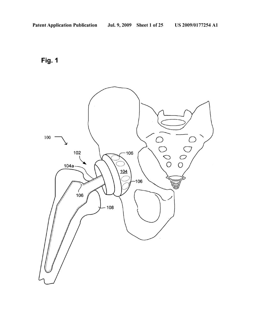 System, devices, and methods including actively-controllable electrostatic and electromagnetic sterilizing excitation delivery system - diagram, schematic, and image 02