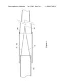 Deployment catheter diagram and image