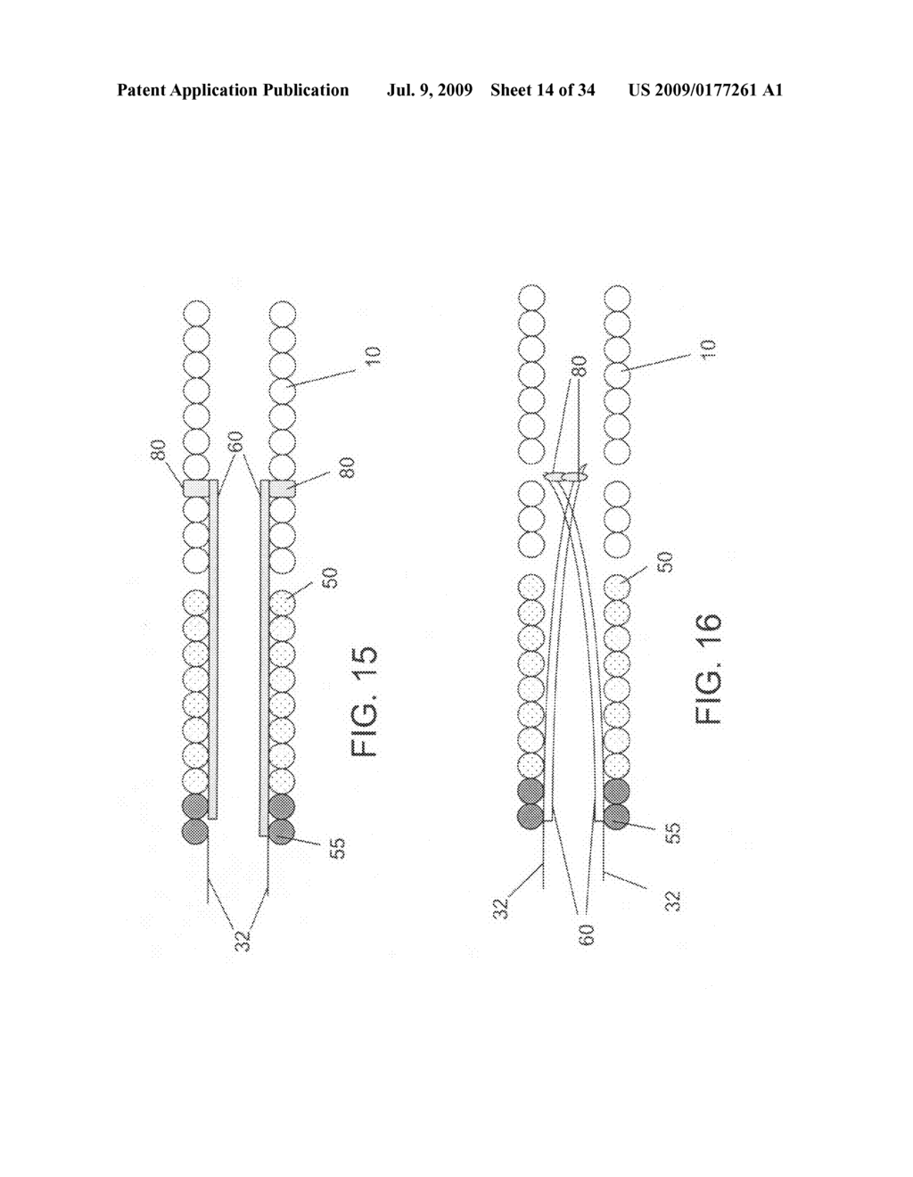 Detachment mechanisms for implantable devices - diagram, schematic, and image 15