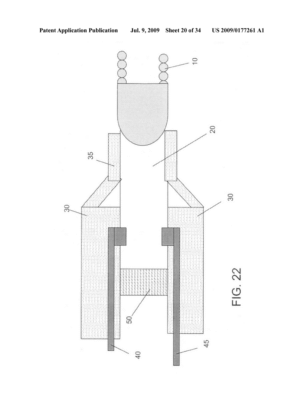 Detachment mechanisms for implantable devices - diagram, schematic, and image 21