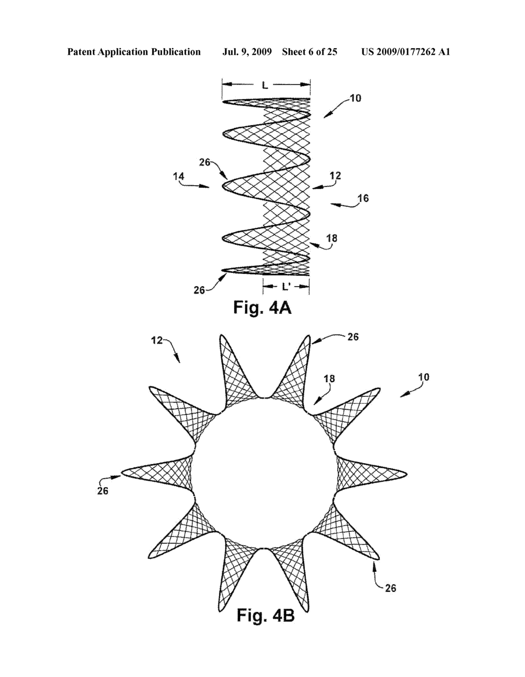 APPARATUS AND METHOD FOR TREATING CARDIOVASCULAR DISEASES - diagram, schematic, and image 07