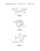 METHODS, SYSTEMS AND DEVICES FOR CARDIAC VALVE REPAIR diagram and image