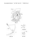 METHODS, SYSTEMS AND DEVICES FOR CARDIAC VALVE REPAIR diagram and image